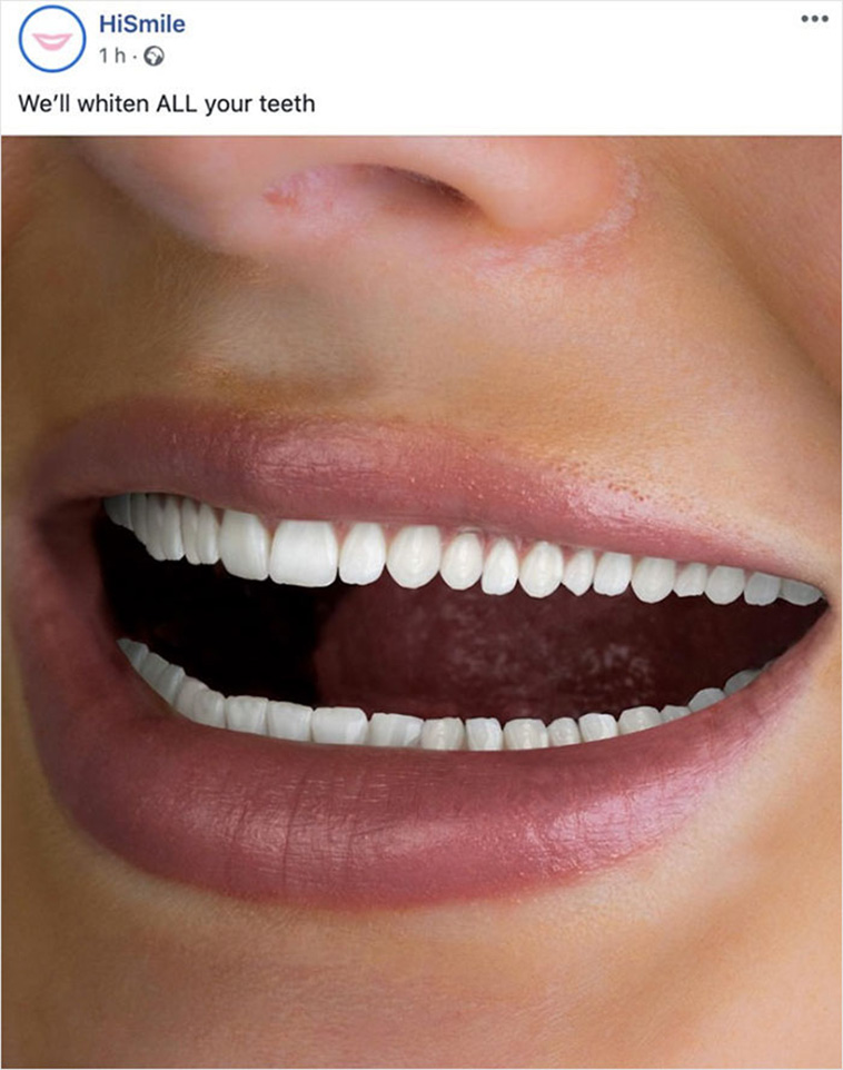white teeth