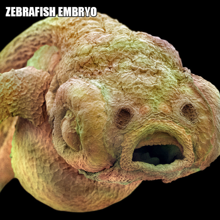 weird microscopic creatures