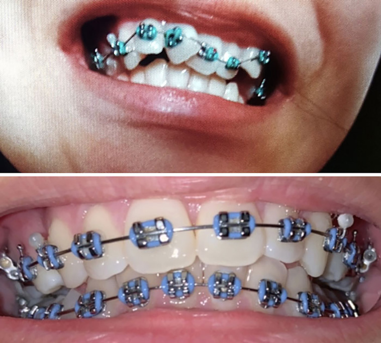 comparison images