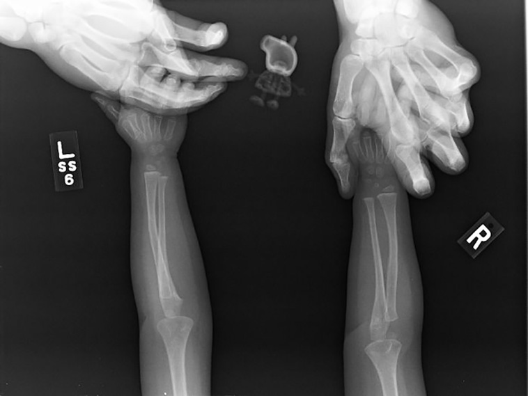 x-rayed things