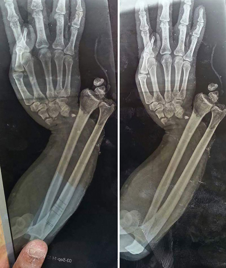 x-rayed things