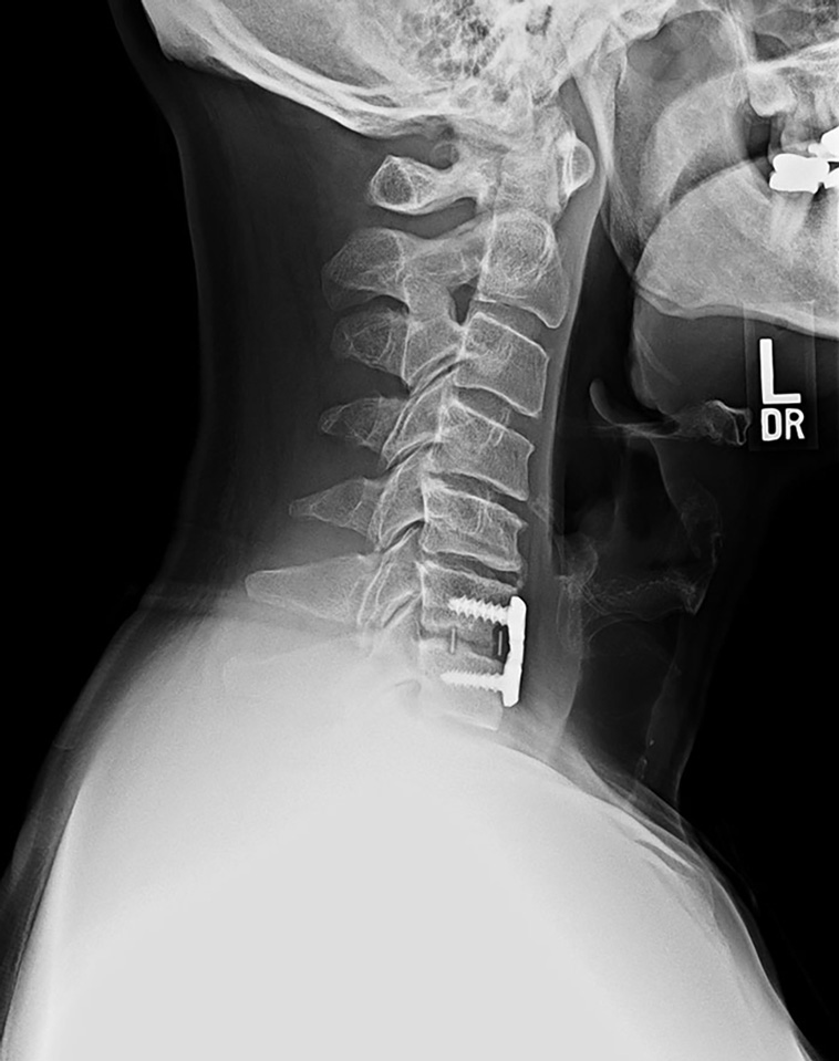 x-rayed things