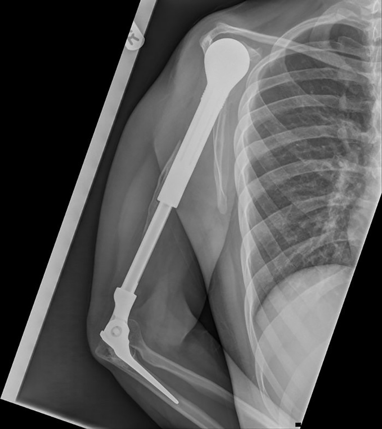 x-rayed things
