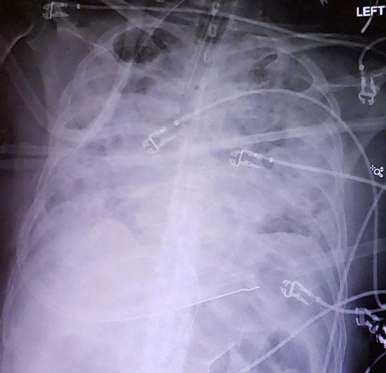 x-rayed things