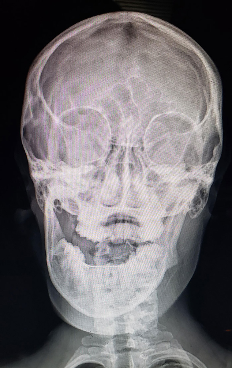 x-rayed things