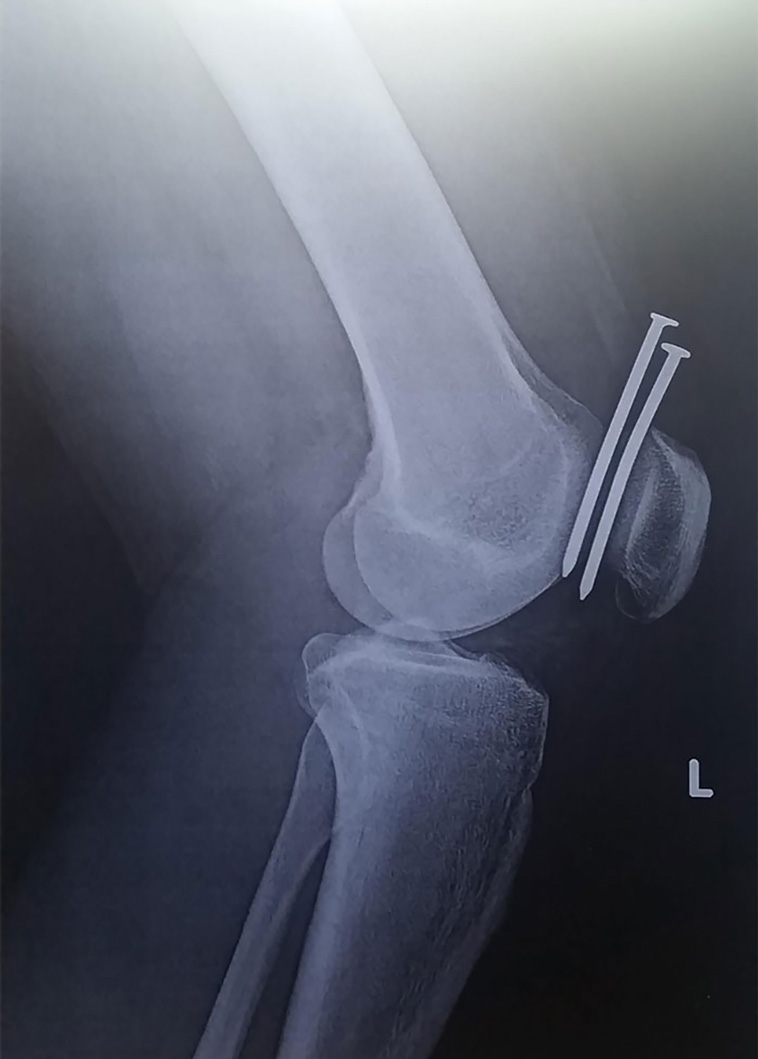x-rayed things