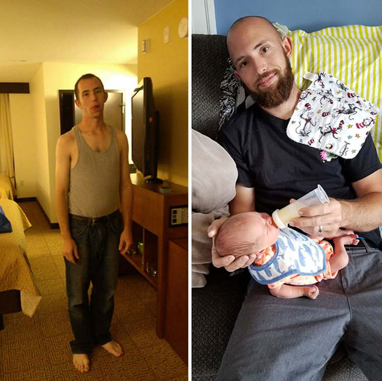drug addiction before after