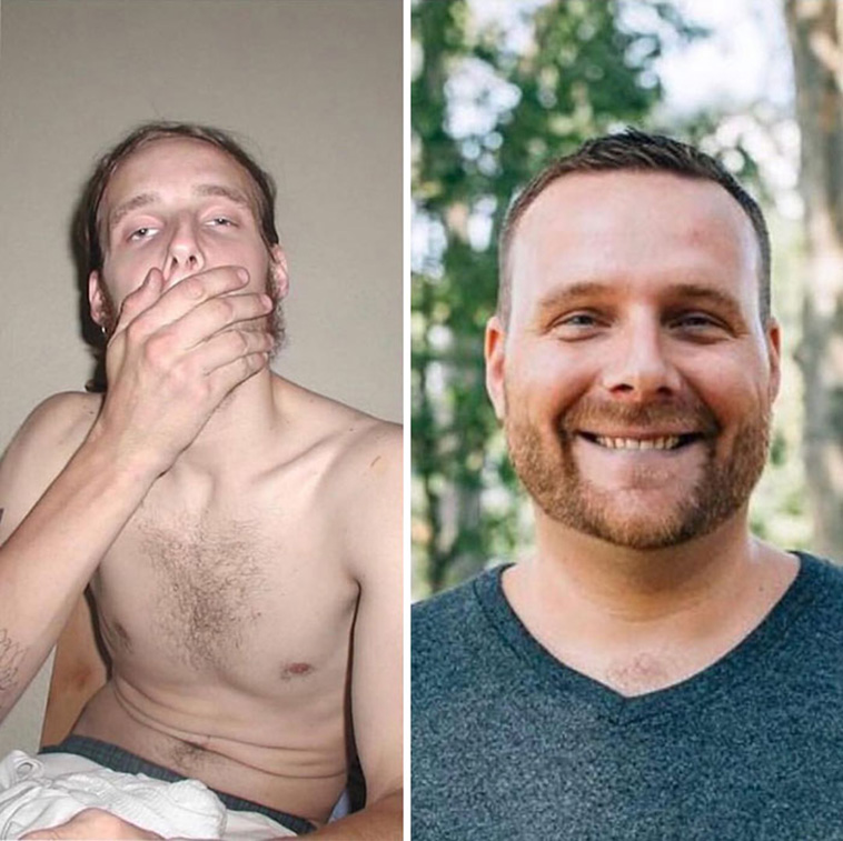 drug addiction before after
