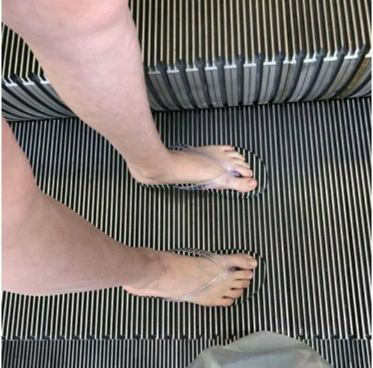 accidental camouflage
