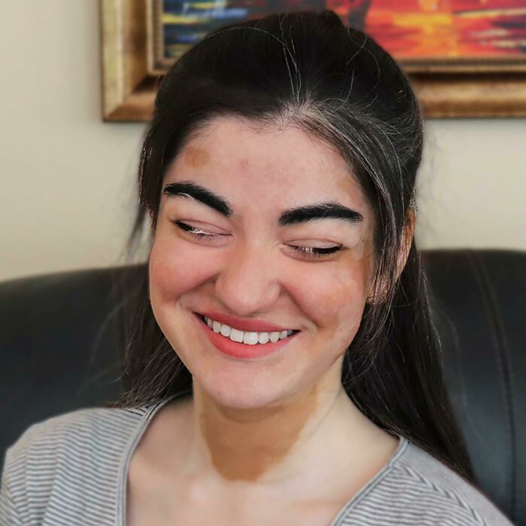 rare genetics