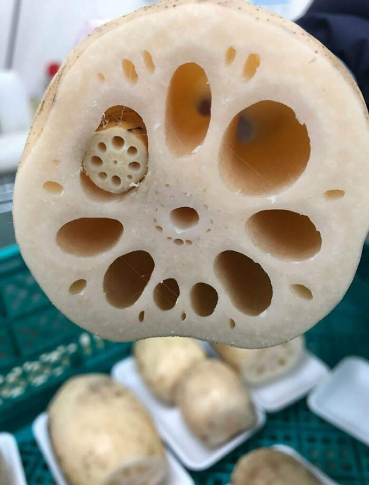 trypophobia