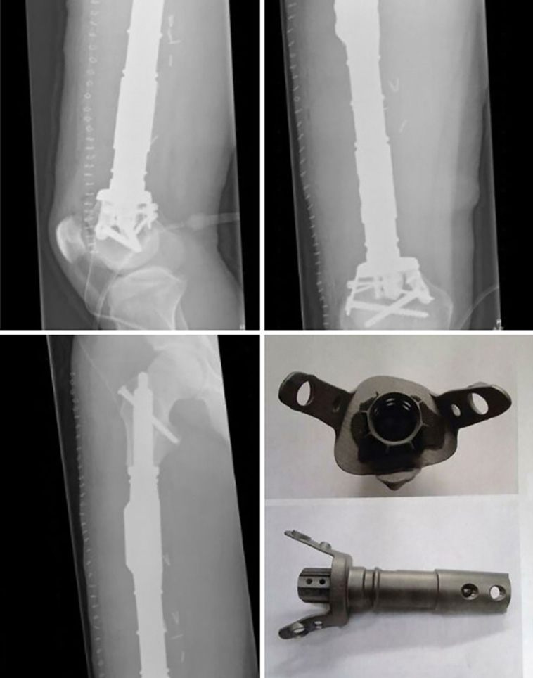 medical cases