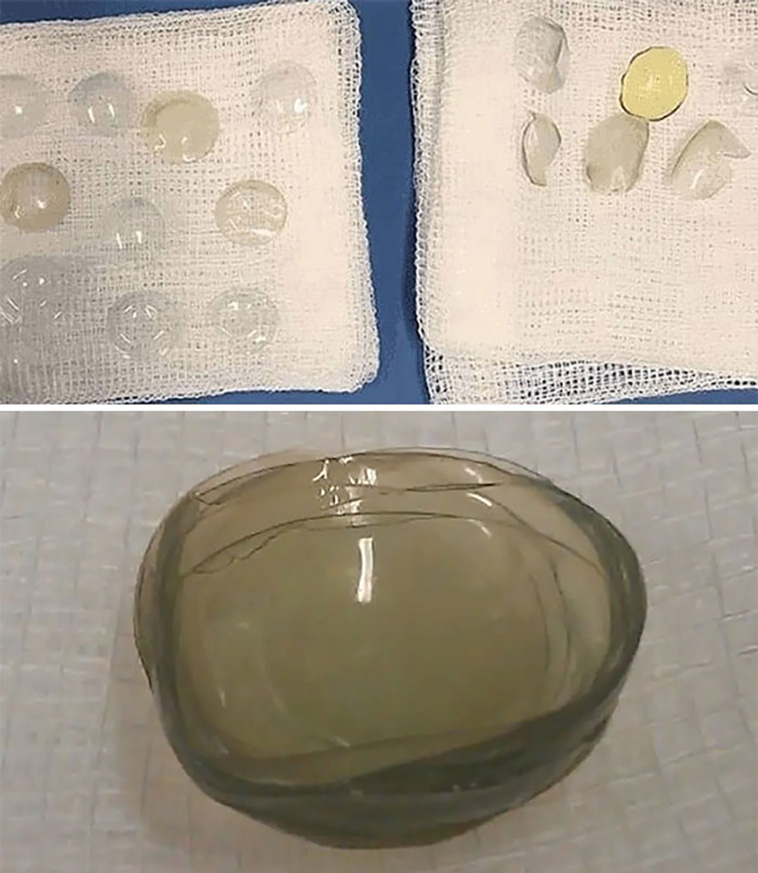 medical cases