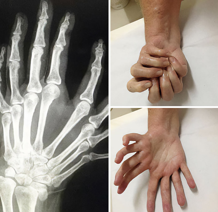 medical cases
