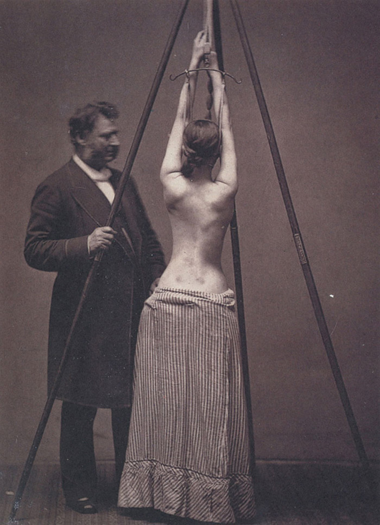 Vintage Photos of Creepy Medical Treatments and Cases